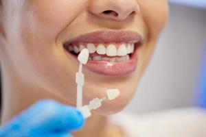 What to Expect During Your First Visit to a Cosmetic Dentist in Ryde