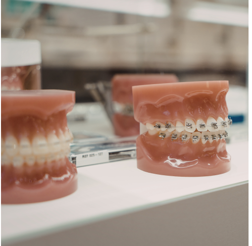 What Is the Cost of Invisalign in Warren?