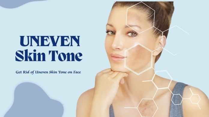 How to Get Rid of Uneven Skin Tone on Face