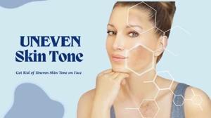 How to Get Rid of Uneven Skin Tone on Face