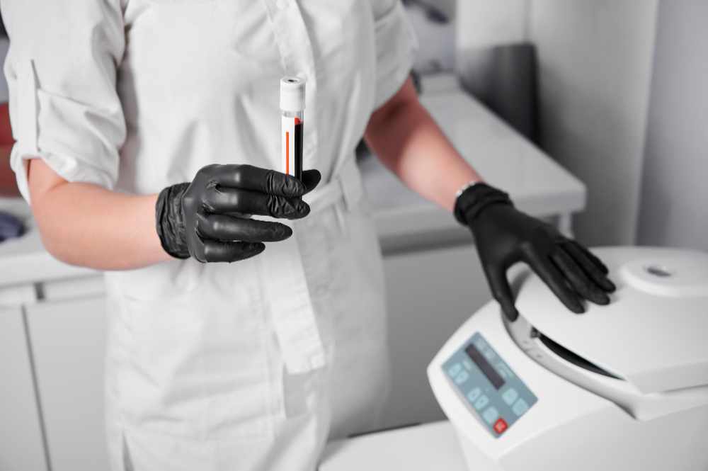 PRP Centrifuge with Higher Yield – Precision & Performance