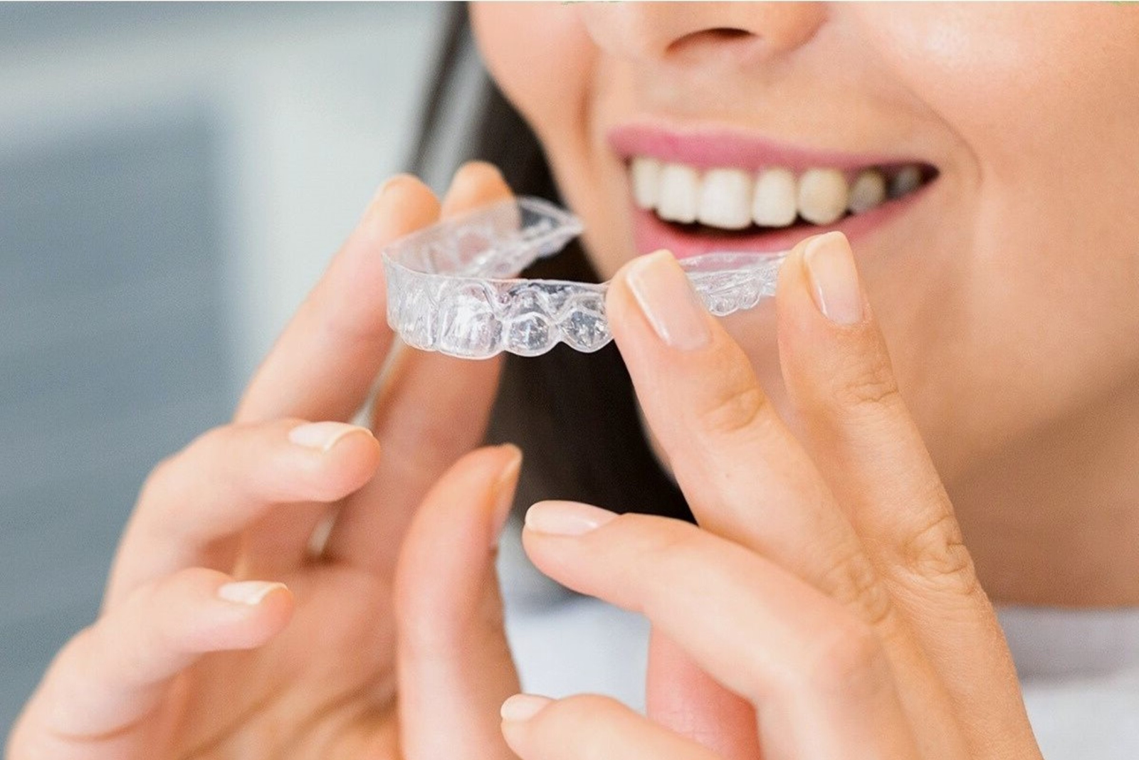 Why Clear Aligners Are a Top Choice for Smile Makeovers