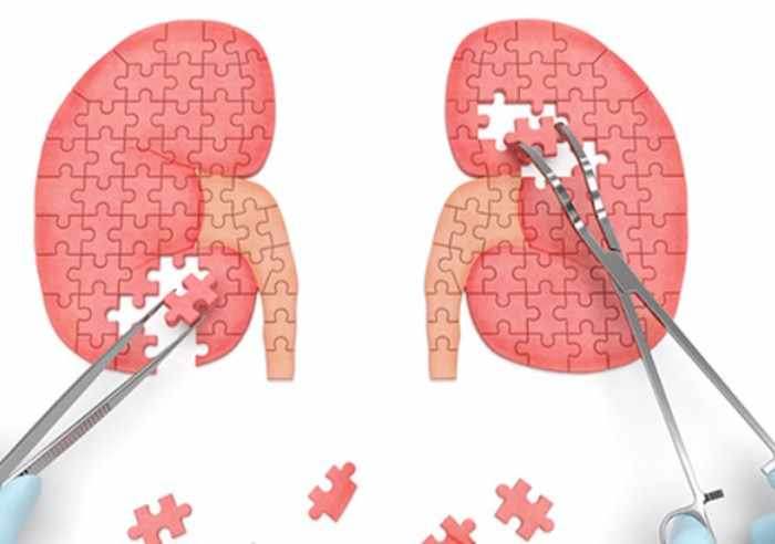 NTP Healthcare: Trusted Name for Kidney Transplant Solutions in India