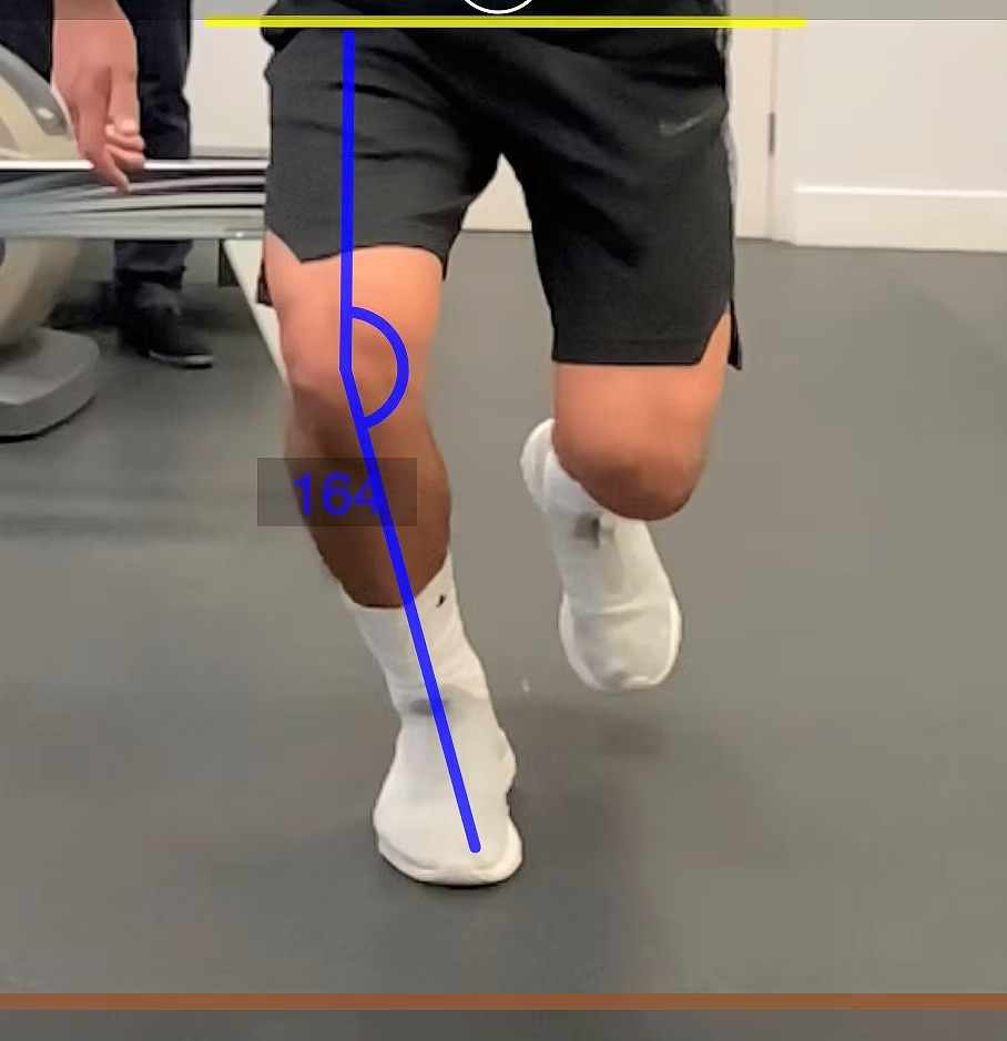 Sports Injury Physiotherapy for Safe Recovery and Stronger Performance