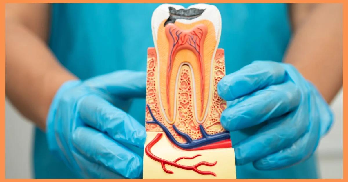 The Real Truth About Root Canal That Your Dentist Wants You to Know