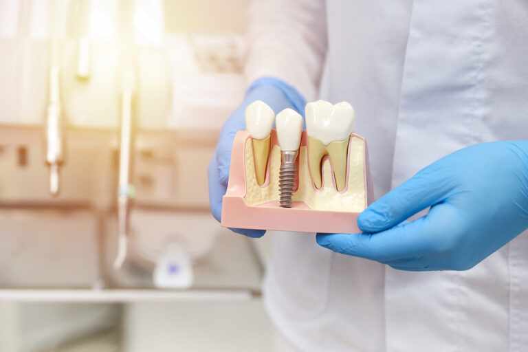 Are Cheap Dental Implants Safe? What You Must Know Before You Decide