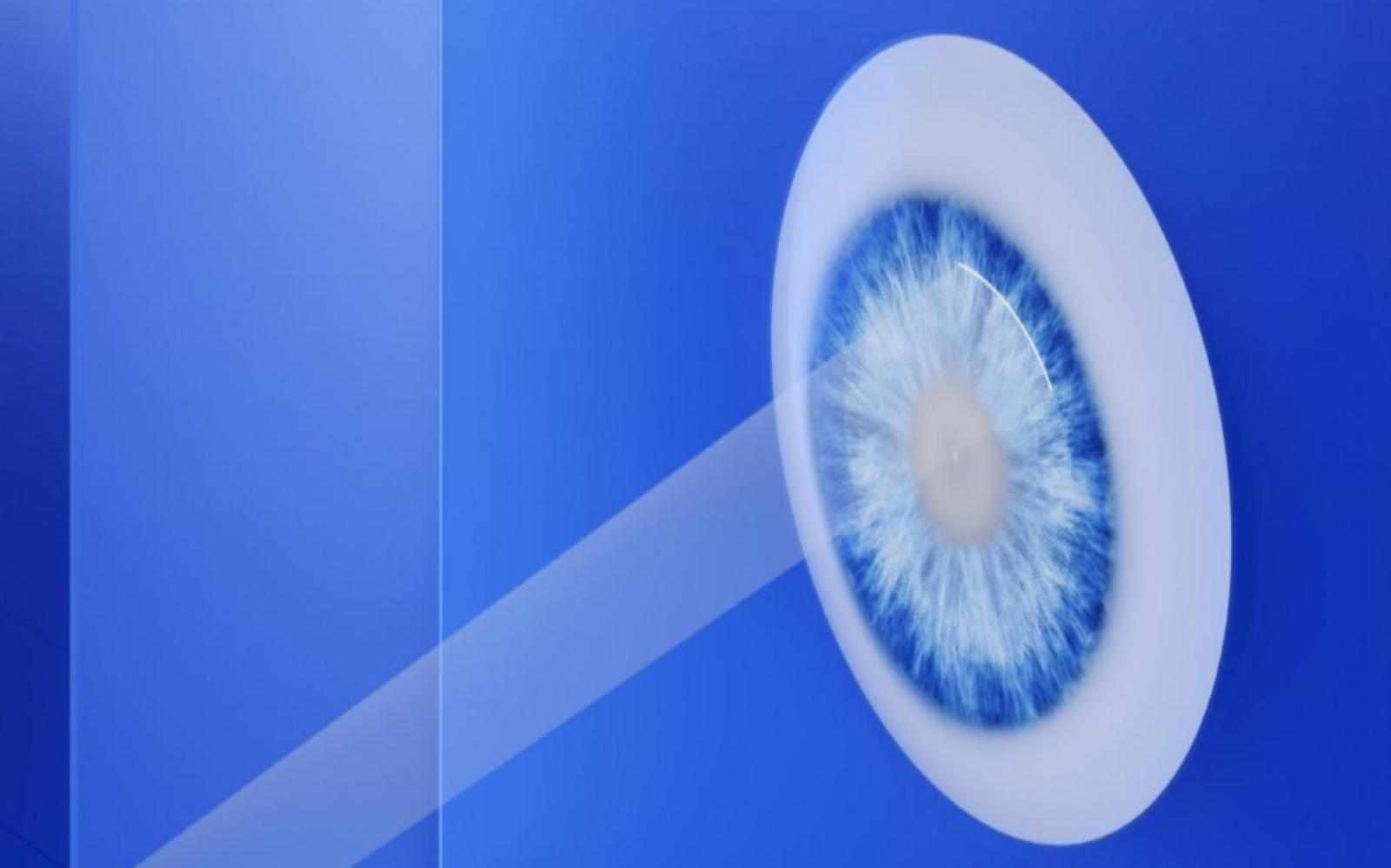 SMILE Laser Eye Surgery for Better Vision