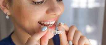 How much does Invisalign cost in Woodstock?