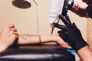 Why the Demand for Tattoo Removal Professionals Is Growing in Australia