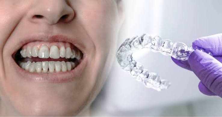 Who offers Invisalign treatments in Boca Raton?