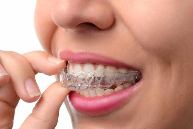 Who is the best orthodontist in Parkland?