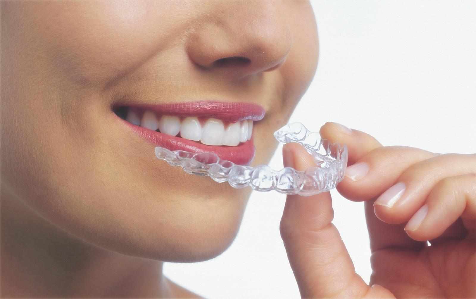 Thinking About Invisalign in Zirakpur? Start with the Right Specialist