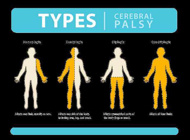 Cerebral Palsy Stem Cell Therapy