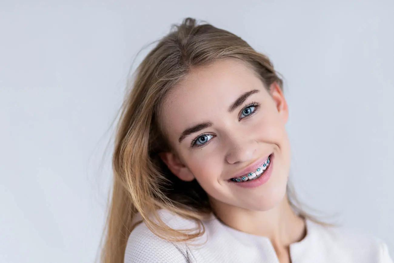 Finding Professional Invisalign Treatment in Rocklin