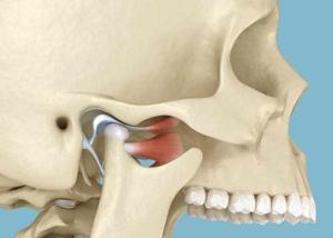 How Much Does TMJ Surgery Cost with Insurance? Complete Breakdown