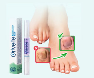 Orivelle Anti Fungus Pen Review | Should You Get It? 2026