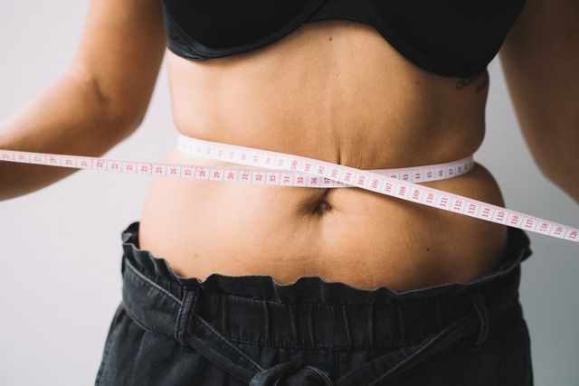 Everything to Know About Getting a Tummy Tuck in Texas