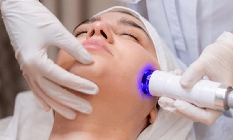 Morpheus 8 Radiofrequency Microneedling: Safe and Effective