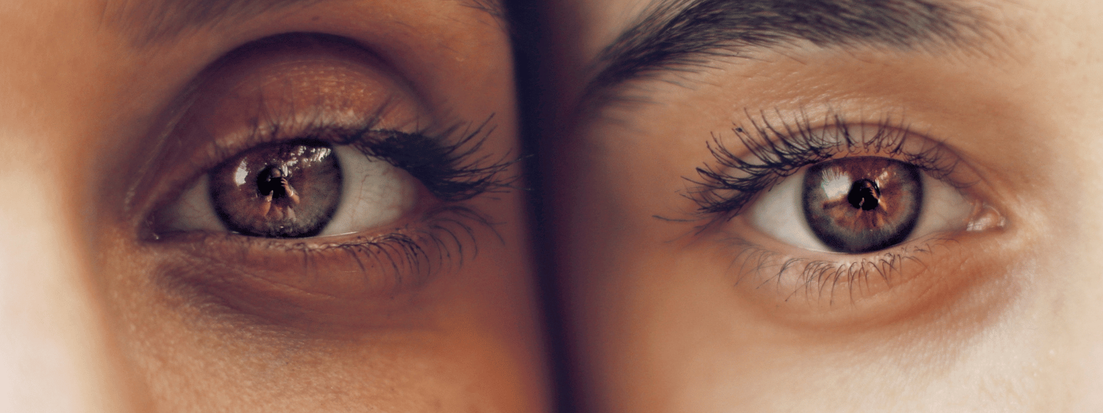 Eyelid Surgery for Men: Addressing Unique Concerns and Expectations