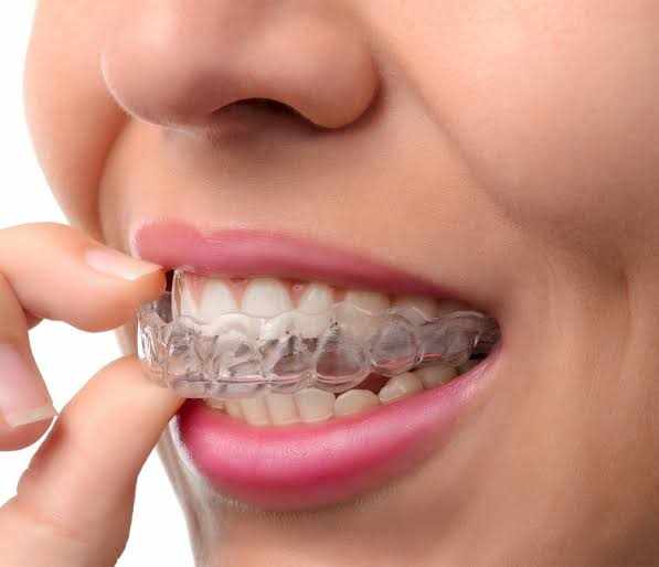 Orthodontist in Dubai: Complete Guide to Orthodontic Treatment