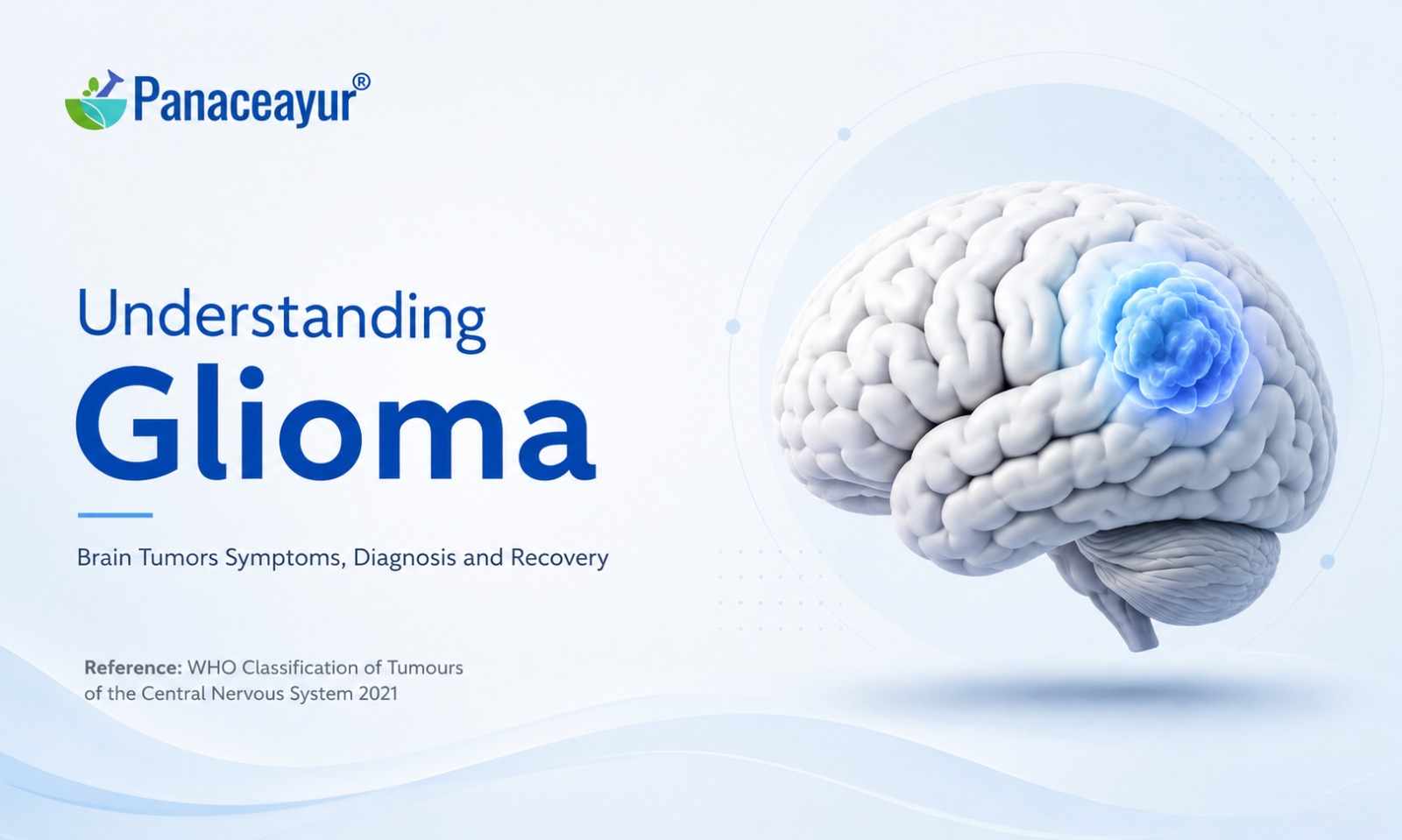 Glioma Brain Tumor: Symptoms, Diagnosis, Treatment and What Patients Should Know