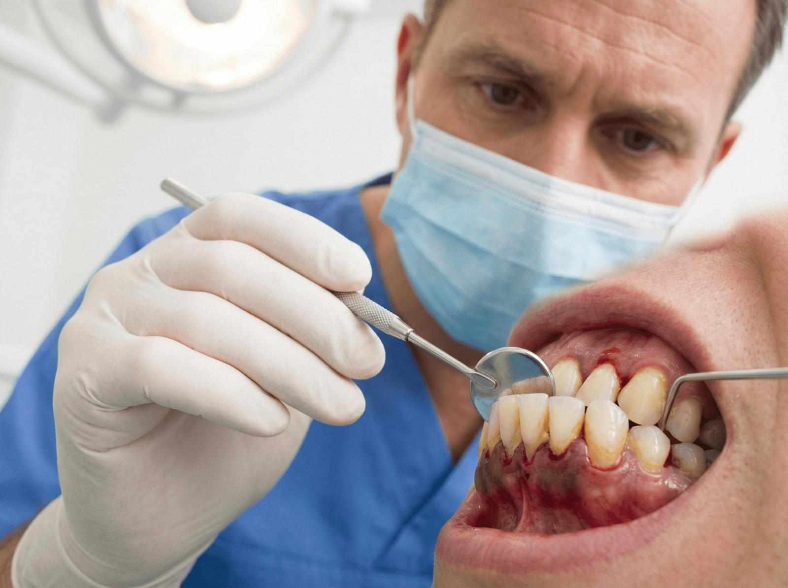 What Happens If You Don't Go to Dentist for 5 Years?