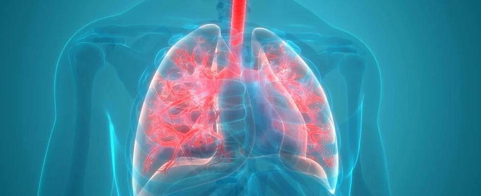 Medications for Pneumonia in New York | Sonder Online Urgent Care