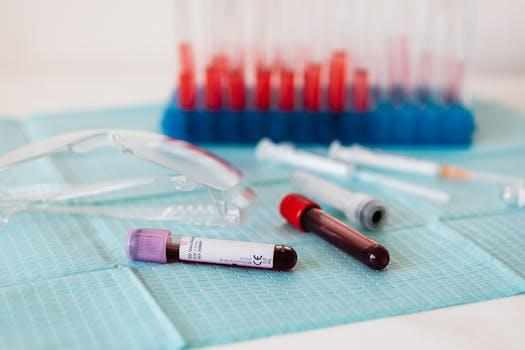 Vitamin B12 Test: Why Early Detection Matters for Mental Health | Biocity Healthcare