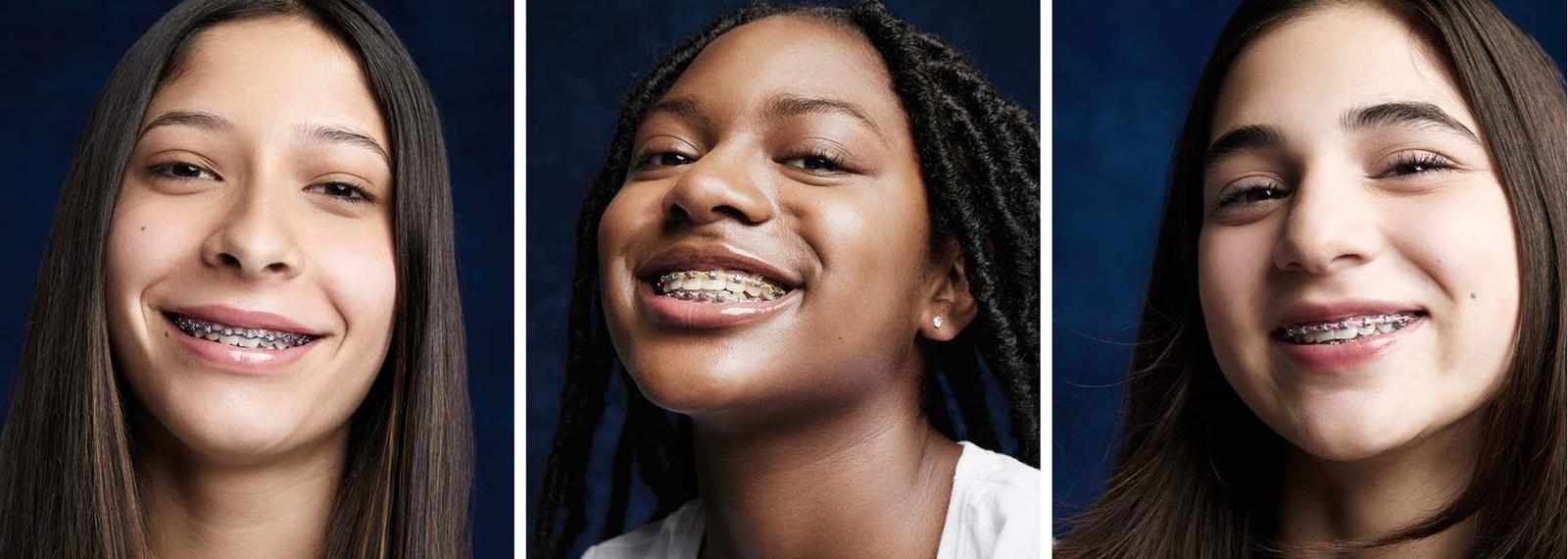 Pompano Beach Braces – Your Route to a Confident Smile