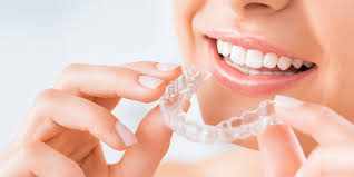Orthodontist in Baltimore Patients also count on to remedy your Smile with decampsortho
