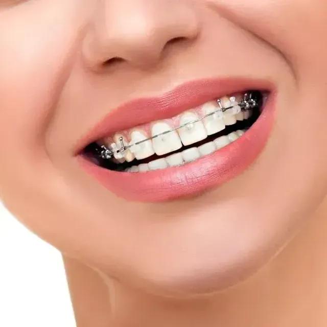 Quality Orthodontics in West Hills