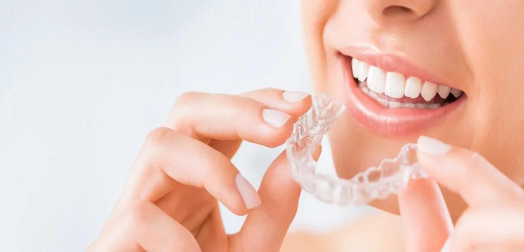 Trusted Orthodontics Services There are plenty of options for Chatsworth braces