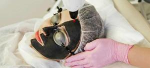 Carbon Peel Treatment: How It Works & Advantages