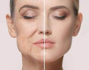 Top  Anti-aging Treatments for Youthful & Glowing Skin