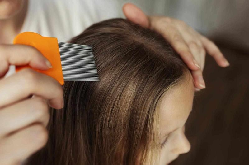 Discover the Best Lice Treatment: Effective Solutions for Quick Relief