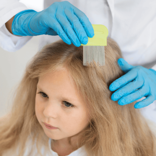 Near Louisiana, a Chemical-Free Lice Removal Service