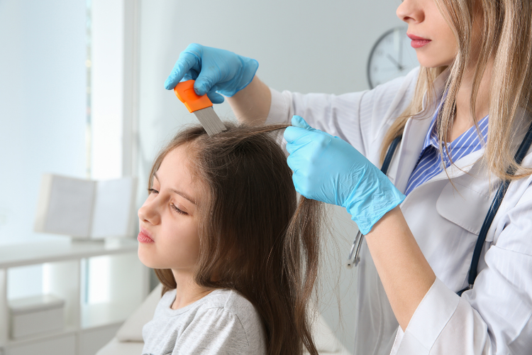 Symptoms to Look for in Head Lice and Nits Signs