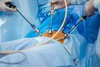 Laparoscopic Surgeon in Dhanori - CT Nursing Home