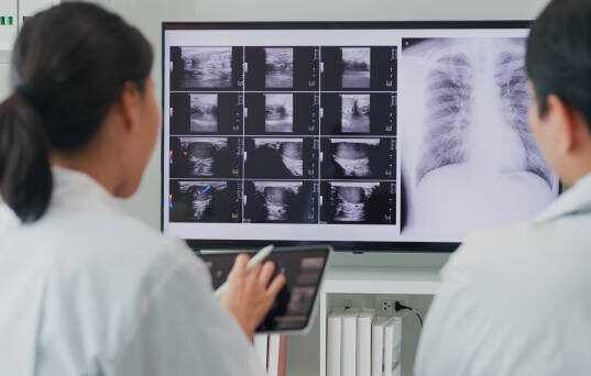 X-Ray Machine Upgrade: Transform Your Imaging with Digital Flat Panel Technology