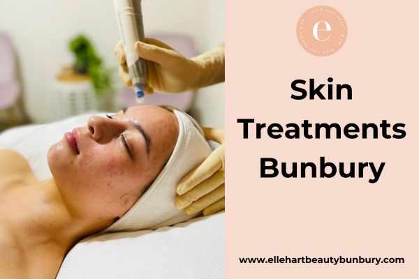 Skin Treatments Bunbury