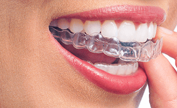 Where To Look For Affordable Invisalign in Bethel? | Brookfield, Connecticut