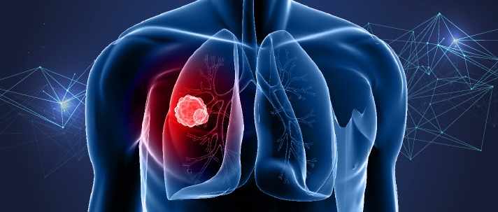Top Pulmonology Doctors and Asthma Specialists in Bakersfield, CA