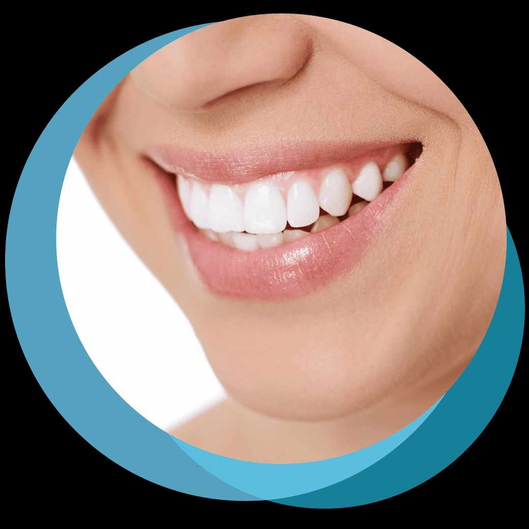 Brighten Your Smile with Expert Dental Care in Canberra