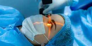 Laser Eye Surgery Price UK: A Clear Breakdown of What You’ll Pay