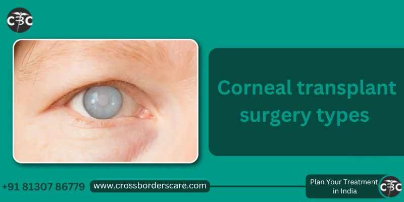 Corneal Transplant Costs in India