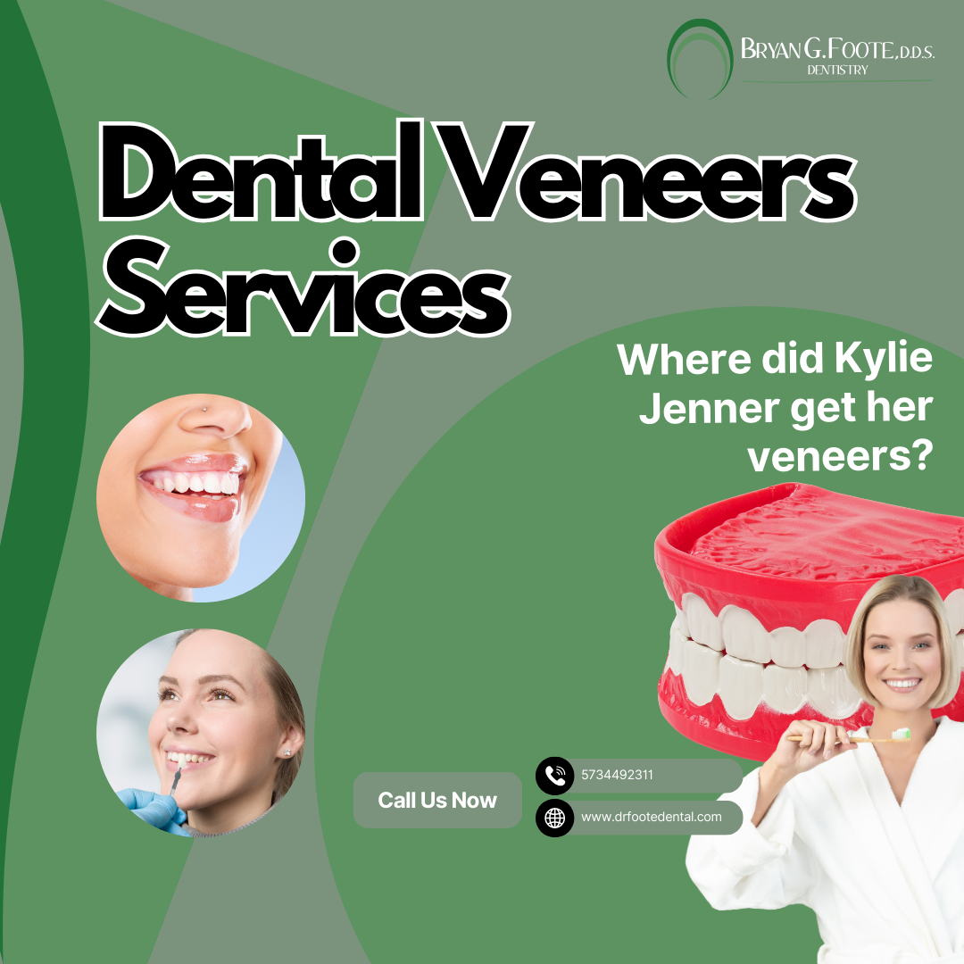 Where did Kylie Jenner get her veneers?