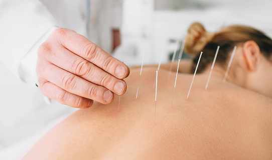 Can the Best Acupuncturist in Long Island Help With Chronic Pain Conditions?