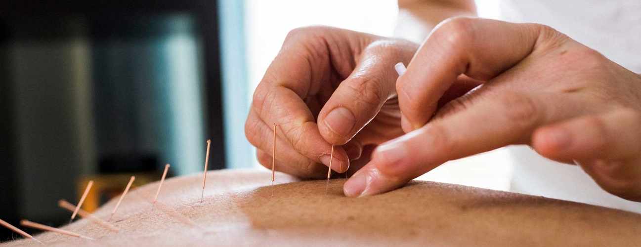 How the Best Acupuncturist on Long Island Treats Chronic Pain Naturally