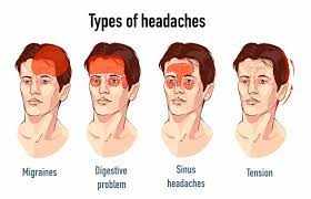 What different types of headaches are there?