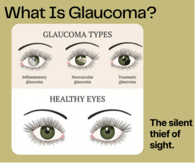 Glaucoma: Leading Cause Of Blindness